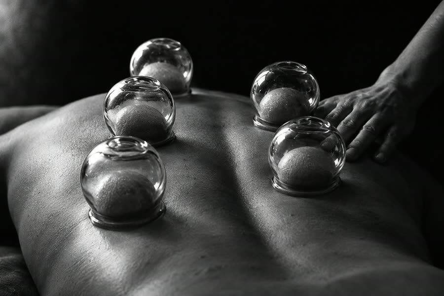 Cupping cups op de rug tijdens een behandeling